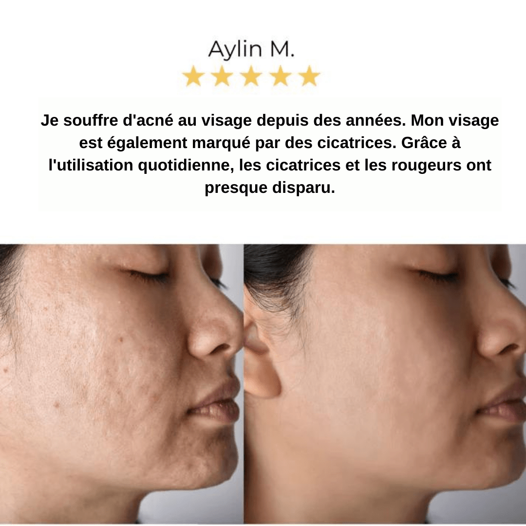 Glowella™ – Appareil de Massage Facial 5-en-1 pour une Peau Radieuse et Rajeunie